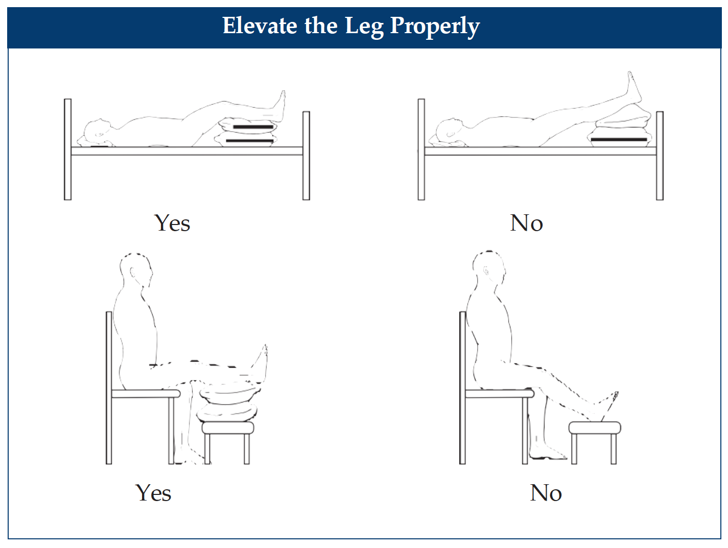 elevate the leg properly